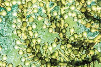 3D ОТПЕЧАТАН ЖИВ МАТЕРИАЛ, КОЙТО МОЖЕ ДА РАСТЕ „НА МЯСТО”